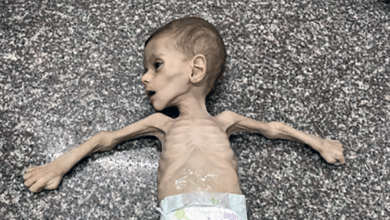 El hambre se cobra las primeras muertes en Gaza