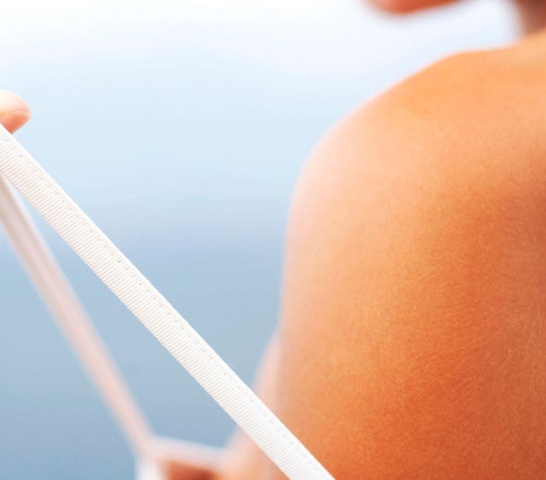 Consejos para evitar quemaduras por el sol en las vacaciones de verano