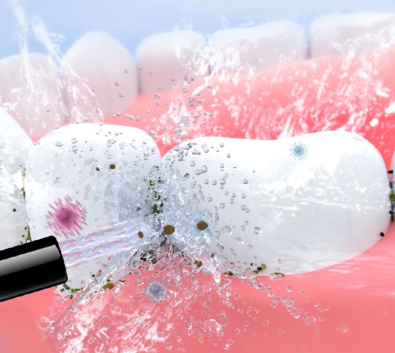 ¿Problemas de encías? Déjalos atrás con este irrigador bucal ¡que cuesta menos de 25€!