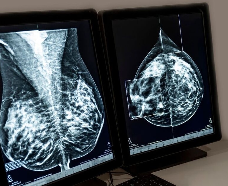La Comisión Europea aprueba Kisqali de Novartis para pacientes con cáncer de mama con alto riesgo de recaída