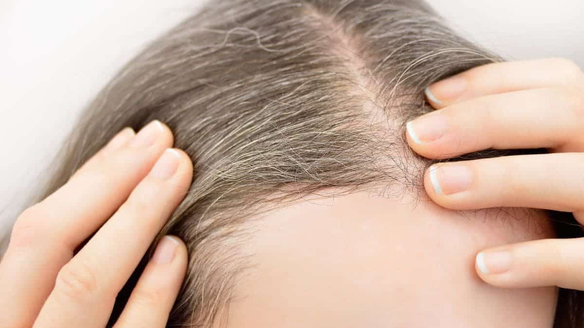 Champú canas