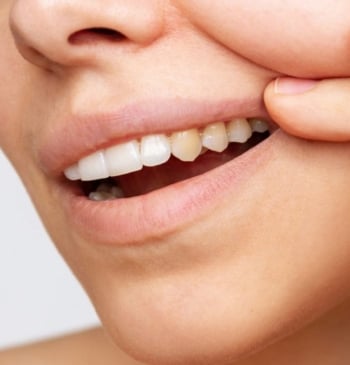 Estos son los alimentos que dañan tus dientes y son mucho peor [...]