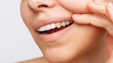 Estos son los alimentos que dañan tus dientes y son mucho peor que el azúcar