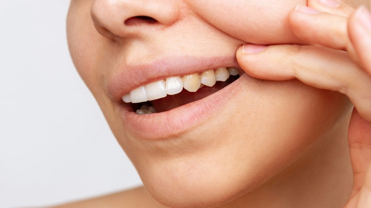 Dientes cuidado