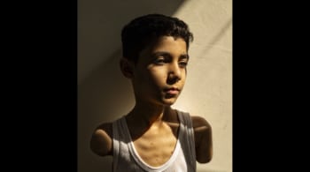 Mahmoud, un niño mutilado de Gaza, foto del año del World Press Photo