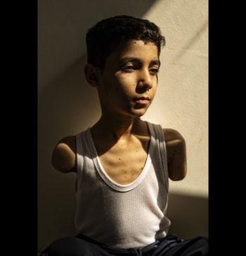Mahmoud, un niño mutilado de Gaza, foto del año del World Press [...]