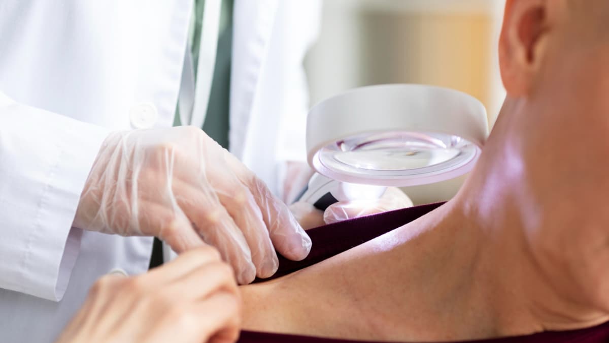 La primavera, un respiro para los pacientes con psoriasis