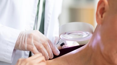 La primavera, un respiro para los pacientes con psoriasis