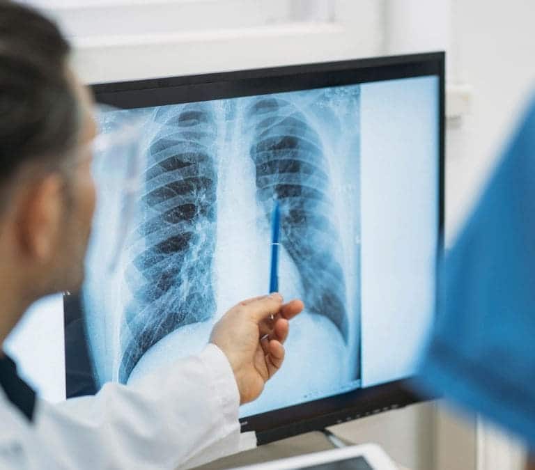 Esta es la forma más sana de mantener limpios los pulmones