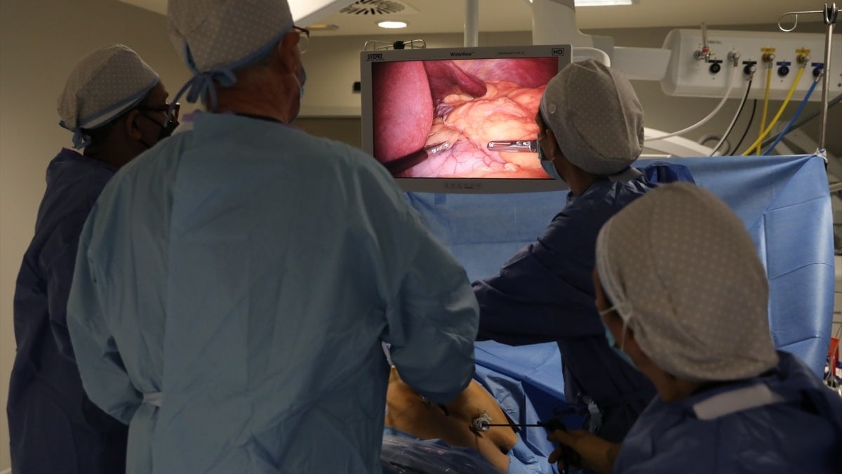 Cirugía de laparoscopia para tratar la obesidad.