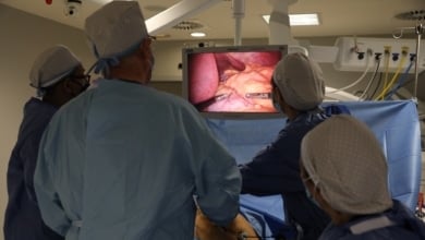 La bacteria intestinal clave para hacer frente a la obesidad, según una nueva investigación