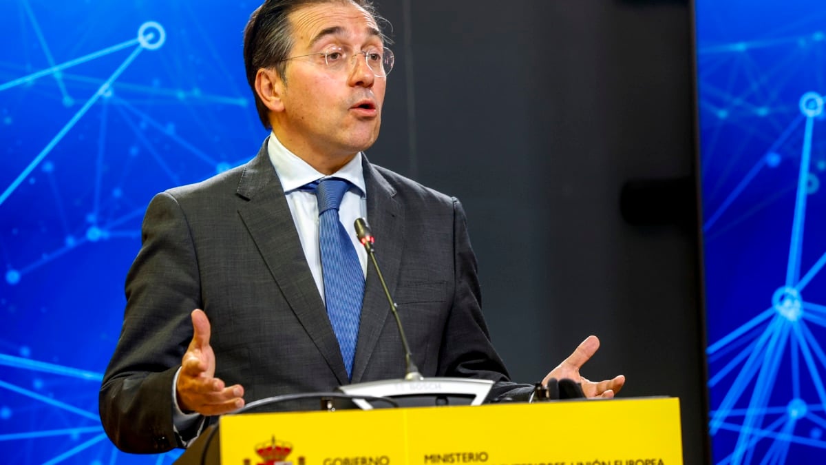 José Manuel Albares