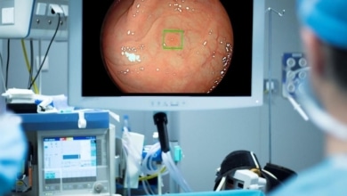 Colonoscopia y test de sangre oculta, igual de eficaces contra cáncer colorrectal