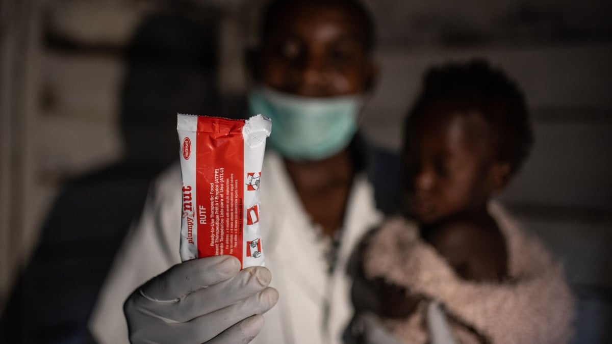 Un sobre que salva vidas: el RUTF y la lucha contra la desnutrición infantil en África