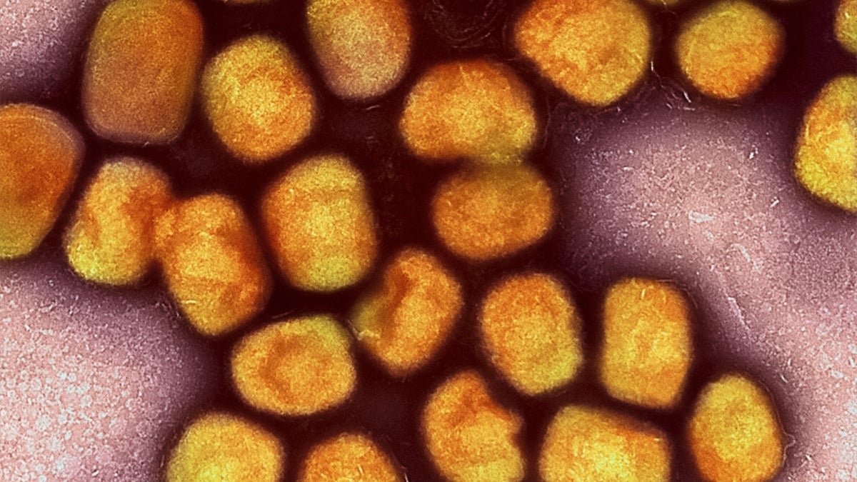 España notifica la primera muerte de un hombre inmunodeprimido y sin vacunar de mpox desde 2022