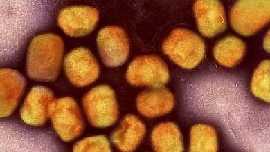 España notifica la primera muerte en un hombre inmunodeprimido y sin vacunar de mpox desde 2022