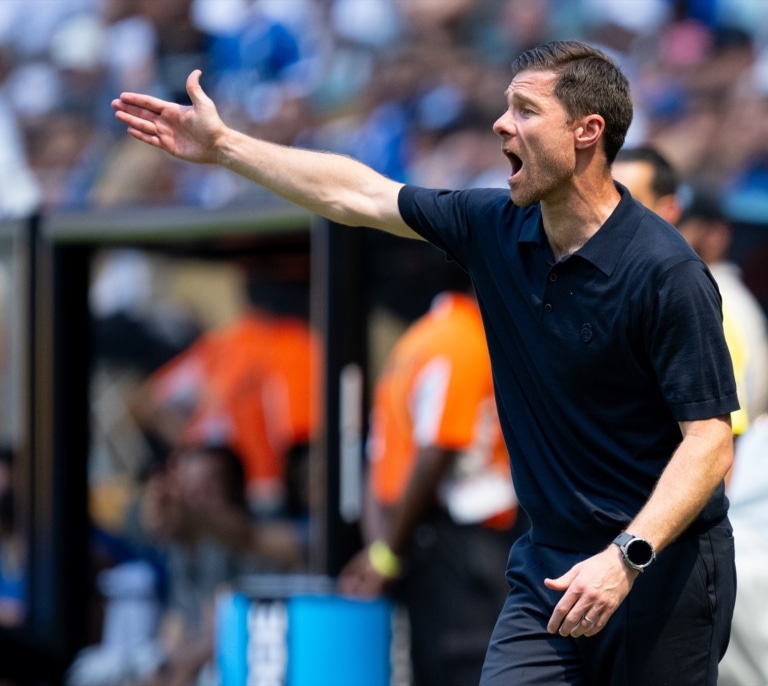 Xabi Alonso: "Mbappé tiene un punto de debilidad para jugar con el nivel competitivo que necesitamos"