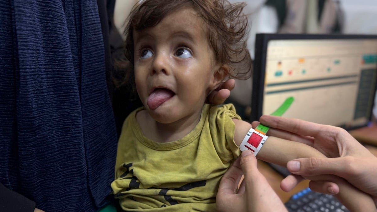 Gaza se muere de hambre: 115 fallecidos por desnutrición y miles de niños en riesgo crítico