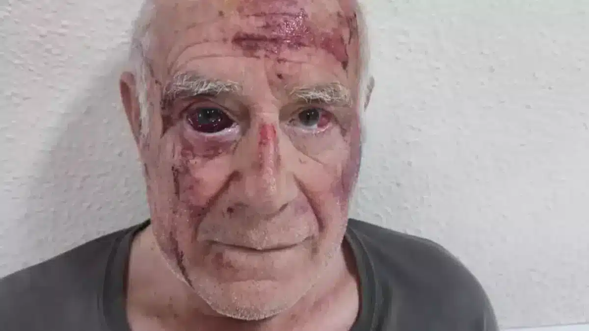 Persona agredida en Torre-Pacheco