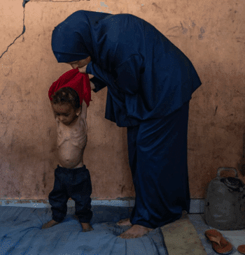 Aumentan las muertes infantiles por desnutrición en Gaza en medio del colapso [...]