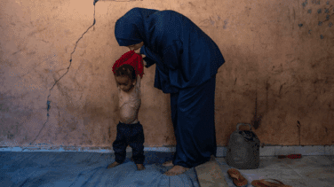 Aumentan las muertes infantiles por desnutrición en Gaza en medio del colapso hospitalario