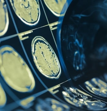 El duelo y el estrés económico se asocian con alteraciones cerebrales vinculadas [...]