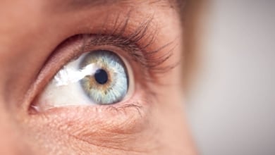 Cómo tratar el síndrome de ojo seco durante el verano
