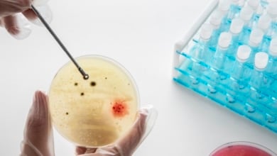 Seis personas adultas y tres menores están hospitalizados en Cartagena por un brote de salmonelosis 