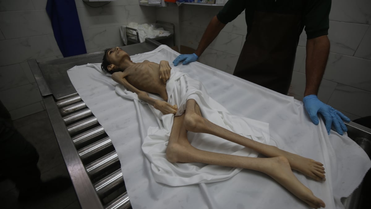 La hambruna en la sitiada Gaza deja ya 300 muertos, entre ellos, 117 niños