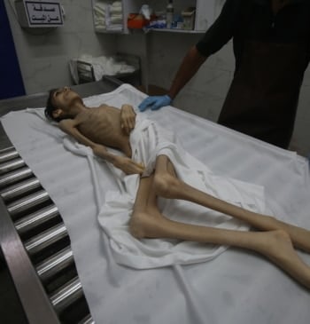 La hambruna en la sitiada Gaza deja ya 300 muertos, entre ellos, [...]