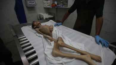 La hambruna en la sitiada Gaza deja ya 300 muertos, entre ellos, 117 niños