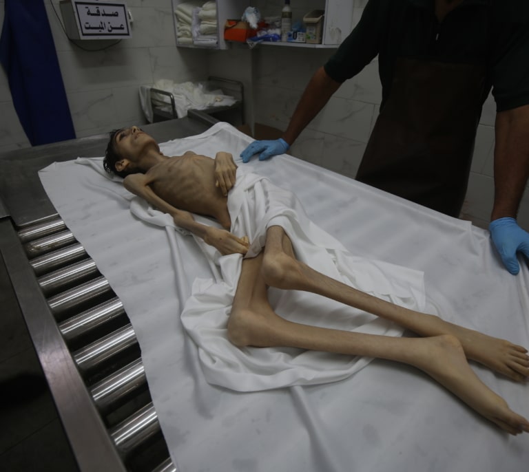 La hambruna en la sitiada Gaza deja ya 300 muertos, entre ellos, 117 niños