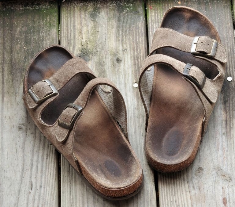 Cómo eliminar las manchas negras de las sandalias en verano