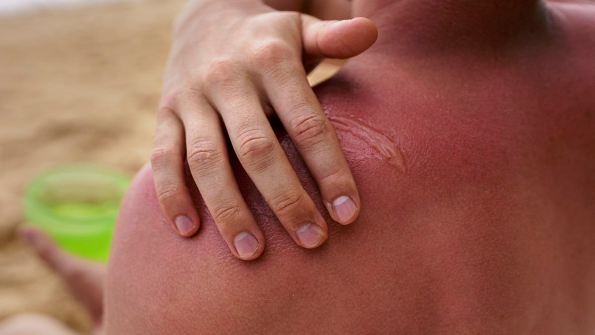 ¿Qué precauciones debes tomar ante los incidentes de verano?