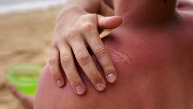 ¿Qué precauciones debes tomar ante los incidentes de verano?
