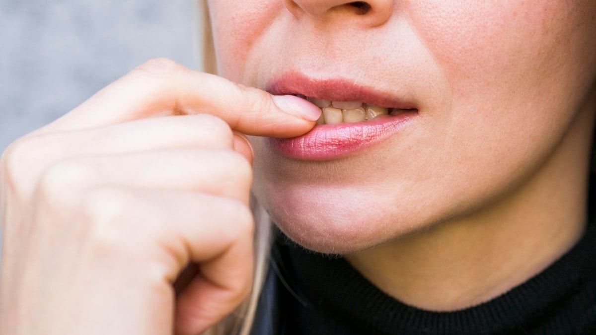 Motivos por los que salen manchas blancas en los dientes