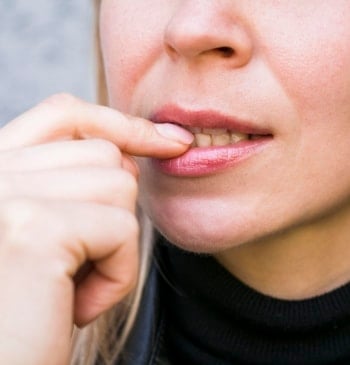 Motivos por los que salen manchas blancas en los dientes
