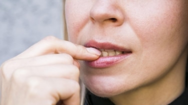 Motivos por los que salen manchas blancas en los dientes
