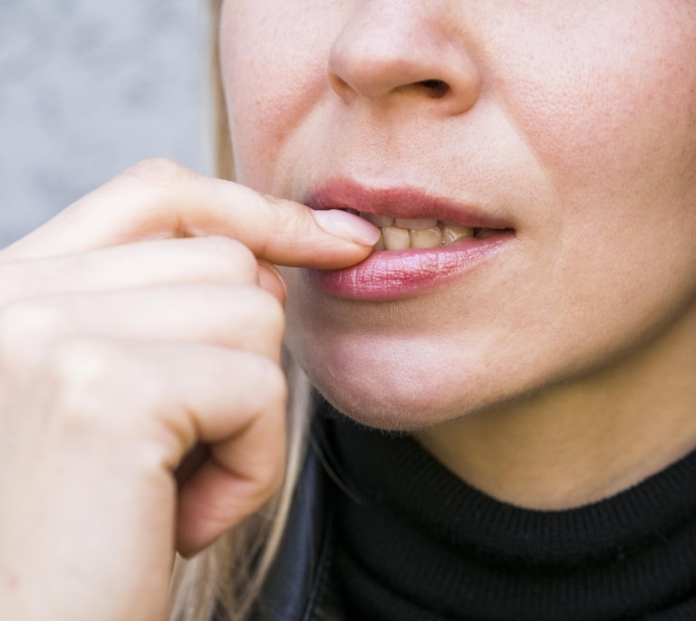 Motivos por los que salen manchas blancas en los dientes
