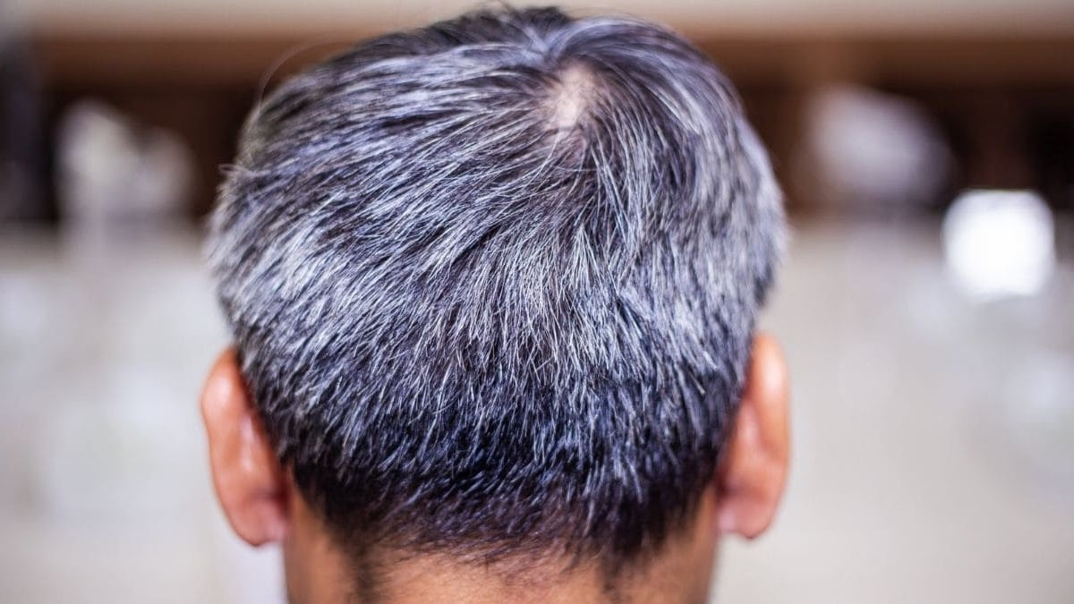 Canas