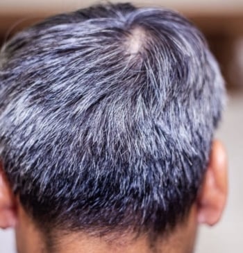 El nuevo ingrediente viral para combatir las canas