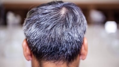El nuevo ingrediente viral para combatir las canas