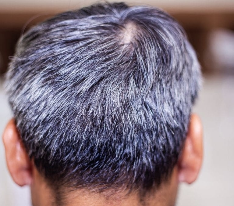 El nuevo ingrediente viral para combatir las canas