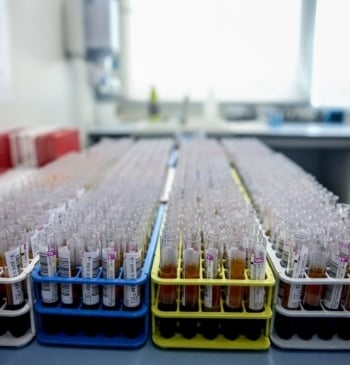 Fiebre del Nilo Occidental: cuatro víctimas mortales en Extremadura este año