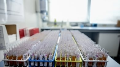 Fiebre del Nilo Occidental: cuatro víctimas mortales en Extremadura este año