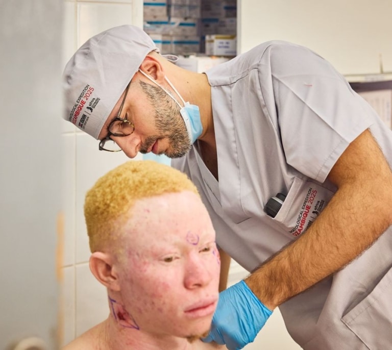 ISDIN y África Directo superan las 5.200 personas con albinismo atendidas en Mozambique contra el cáncer de piel