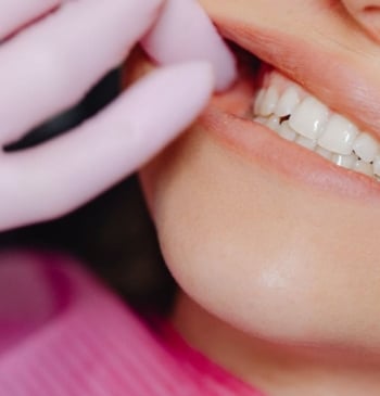 Este es el motivo real por el que los dientes se ponen [...]