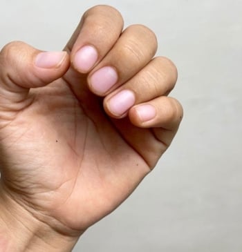 Estas son las causas y las consecuencias de morderse las uñas