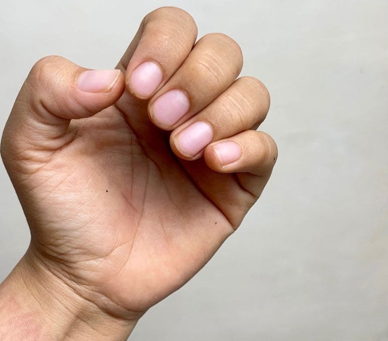 Estas son las causas y las consecuencias de morderse las uñas