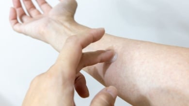 Así afecta el frío y la calefacción a la piel en invierno